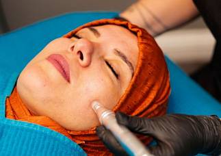 Microneedling schenkt ebenmäßigere, straffe Haut ohne OP.